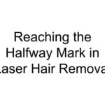 Reaching the Halfway Mark in Laser Hair Removal